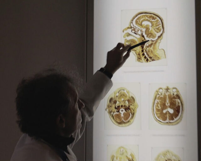 Photo of neuroscientist looking at brain scans